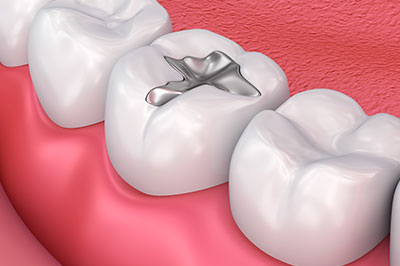 The image displays a close-up view of a set of teeth with a diamond ring embedded between two front teeth.