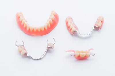 The image shows a collection of dental implants with teeth and gums displayed on a white background.