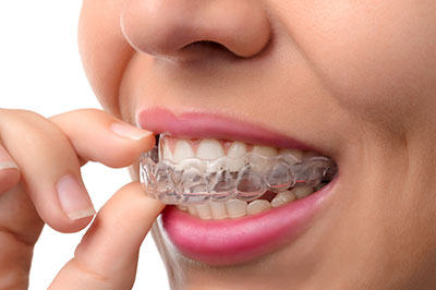 The image shows a person with their hand holding an orthodontic appliance up to their mouth, which appears to be a clear aligner tray used for teeth straightening.