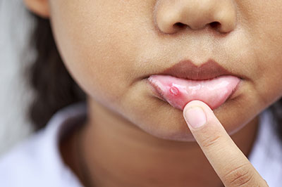 A child s hand with an open mouth, touching their lips while looking at the camera.