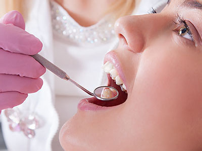 Dental hygienist performing dental work on patient s teeth while patient is wearing purple gloves.